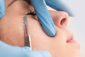 Dermaplaning Treatment
